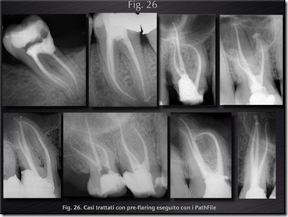 endodonzia cantatore endodonzia cantatore