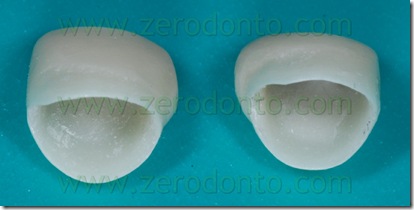 cappa ceramica