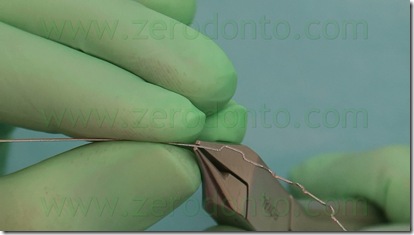 modellazione del retainer attivo