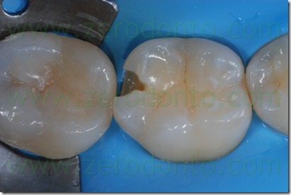Fig0072Rosti Q4