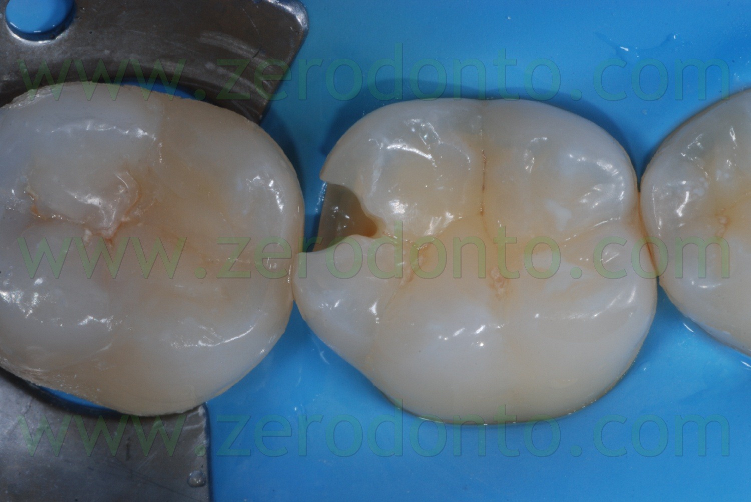 [Fig0072Rosti Q4[5].jpg]