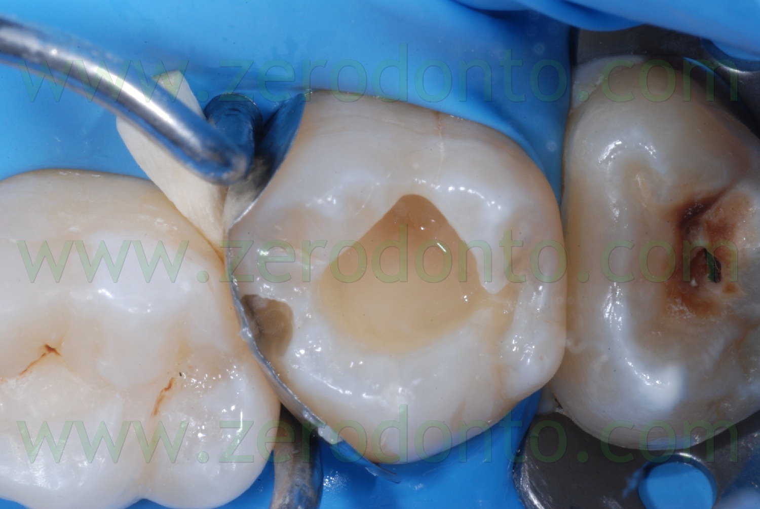 [Fig0055Rosti Q2[2].jpg]