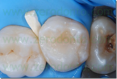 Fig0057Rosti Q2