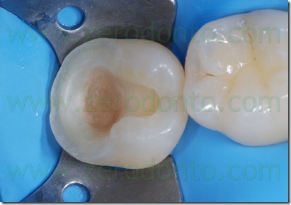 Fig0065Rosti Q4