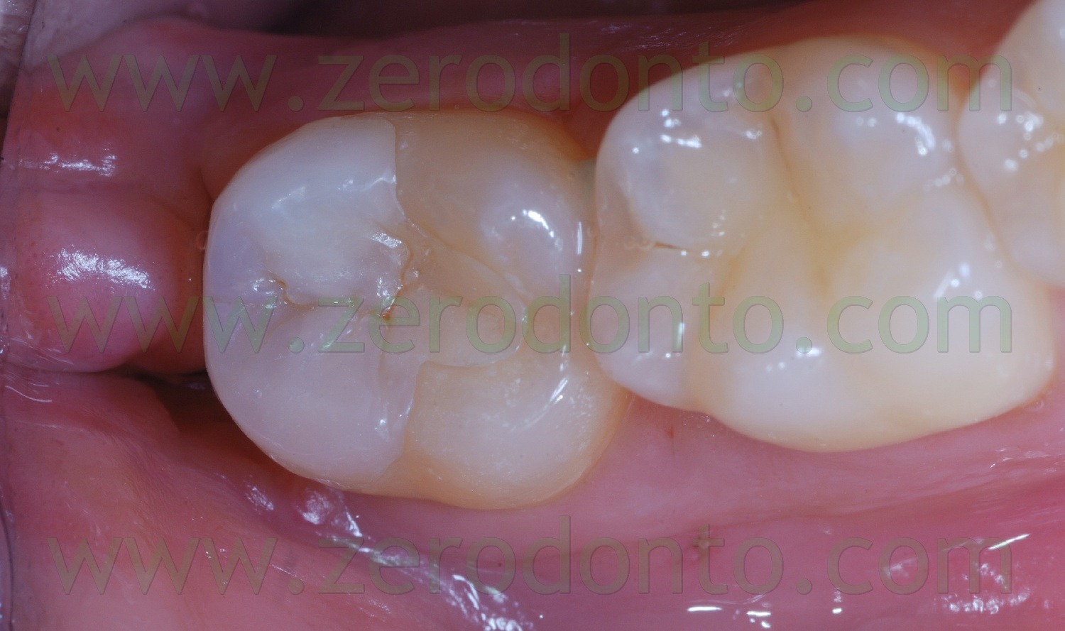 [Fig0067Rosti Q4[2].jpg]