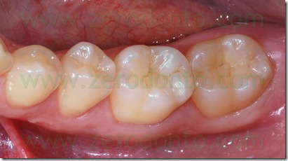 Fig0093Rosti Q3