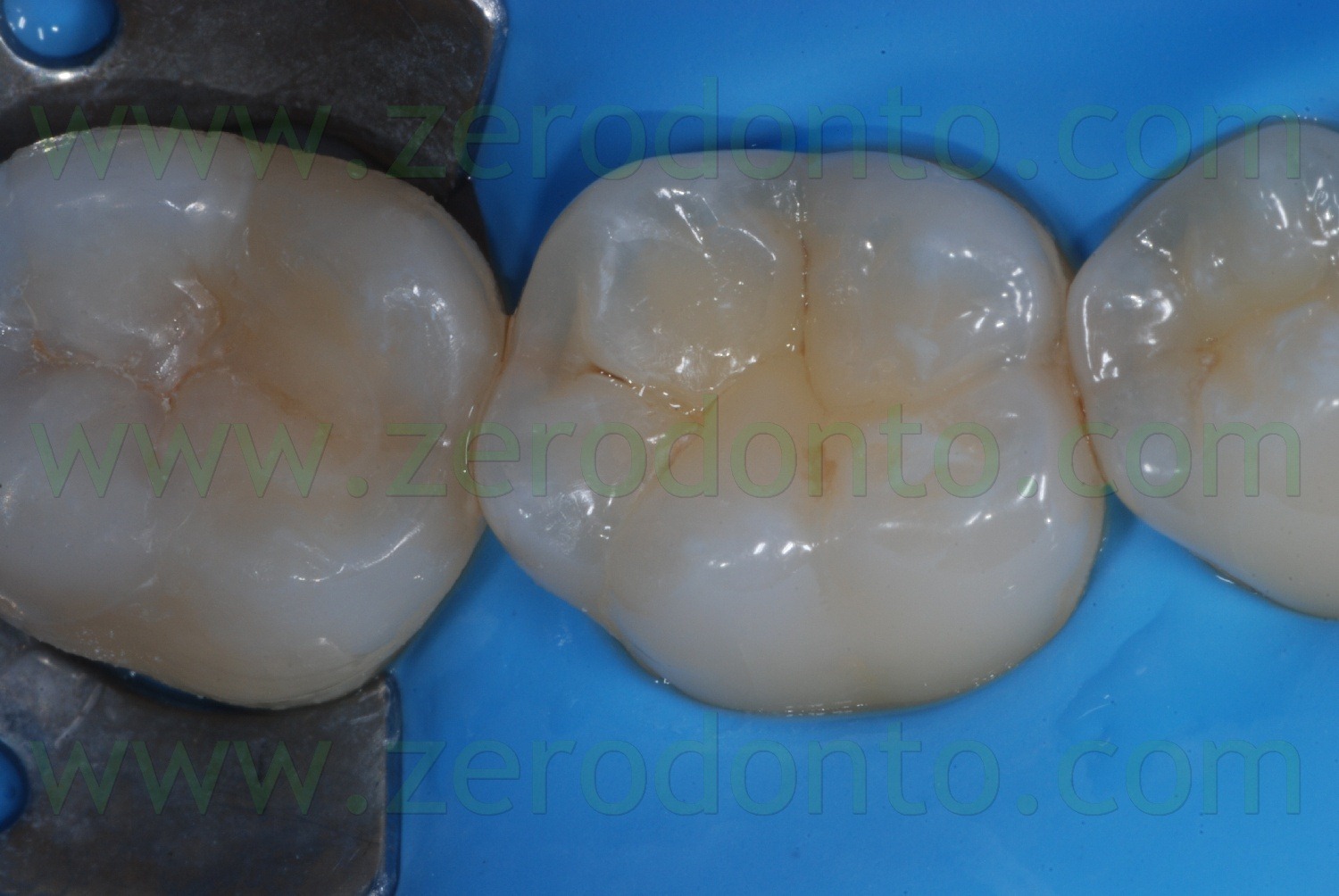 [Fig0071Rosti Q4[2].jpg]