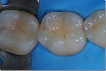 Fig0071Rosti Q4