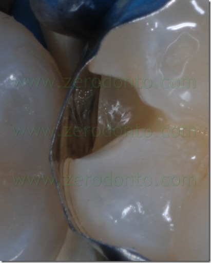Fig0074Rosti Q4