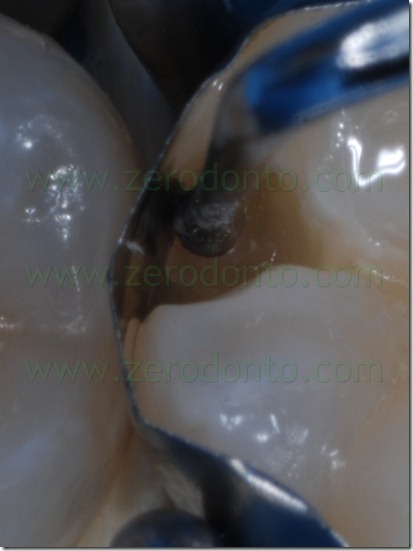 Fig0075Rosti Q4