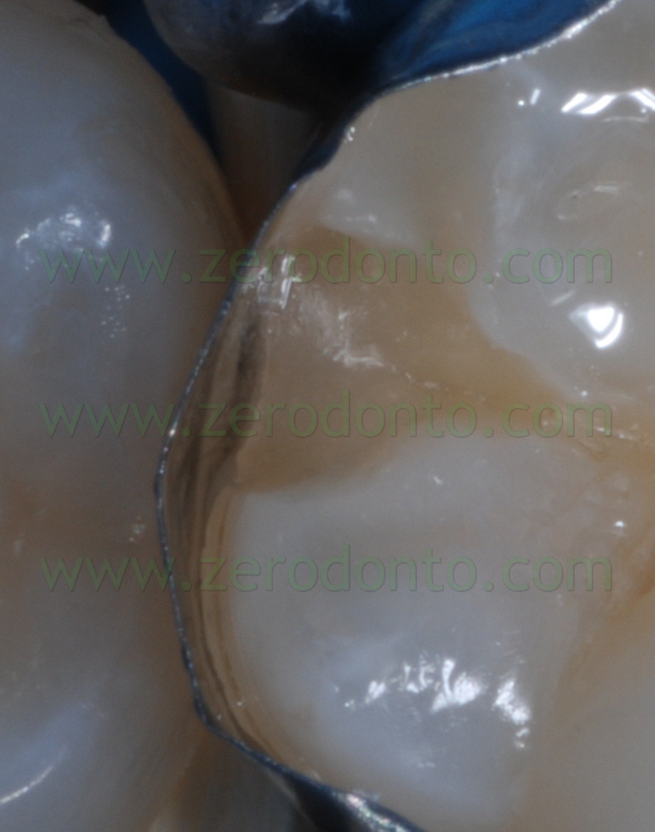 [Fig0076Rosti Q4[3].jpg]