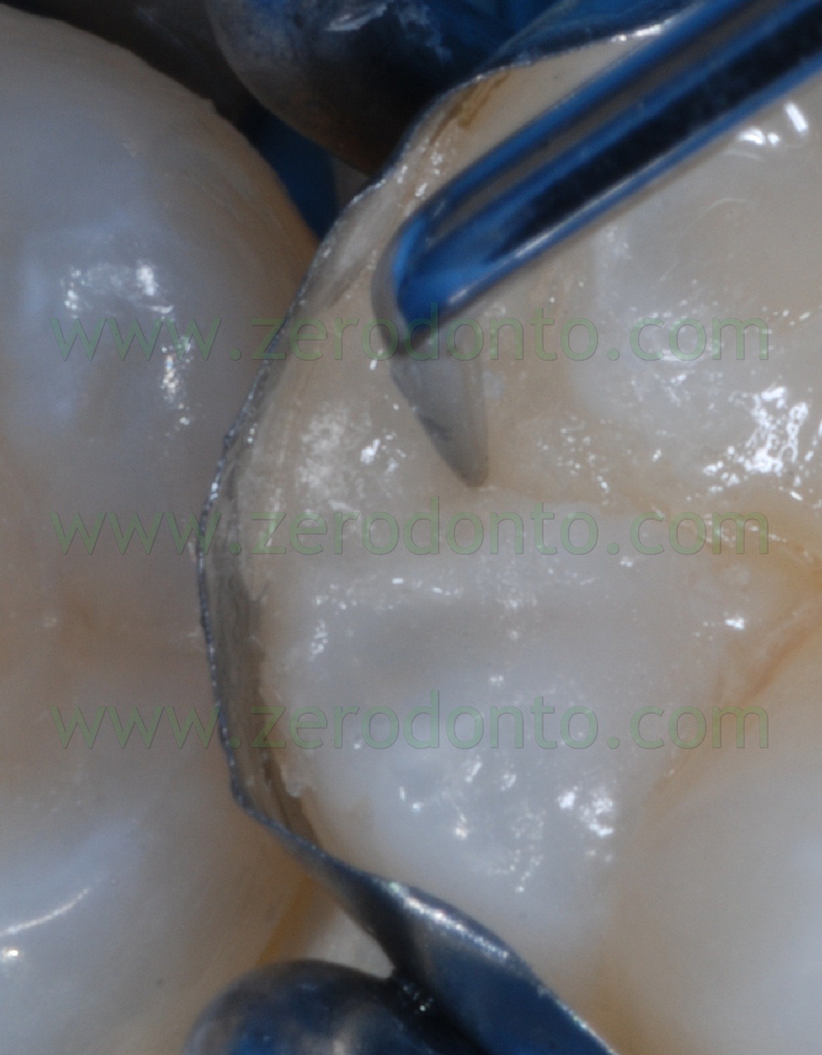 [Fig0077Rosti Q4[3].jpg]