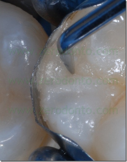 Fig0077Rosti Q4