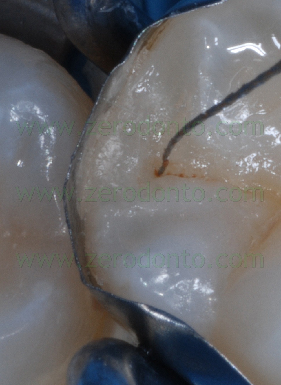 [Fig0078Rosti Q4[3].jpg]