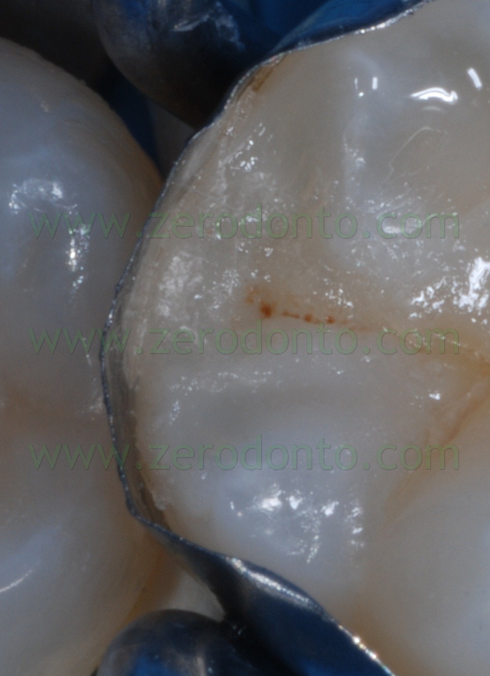 [Fig0079Rosti Q4[4].jpg]
