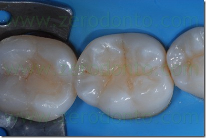 Fig0080Rosti Q4