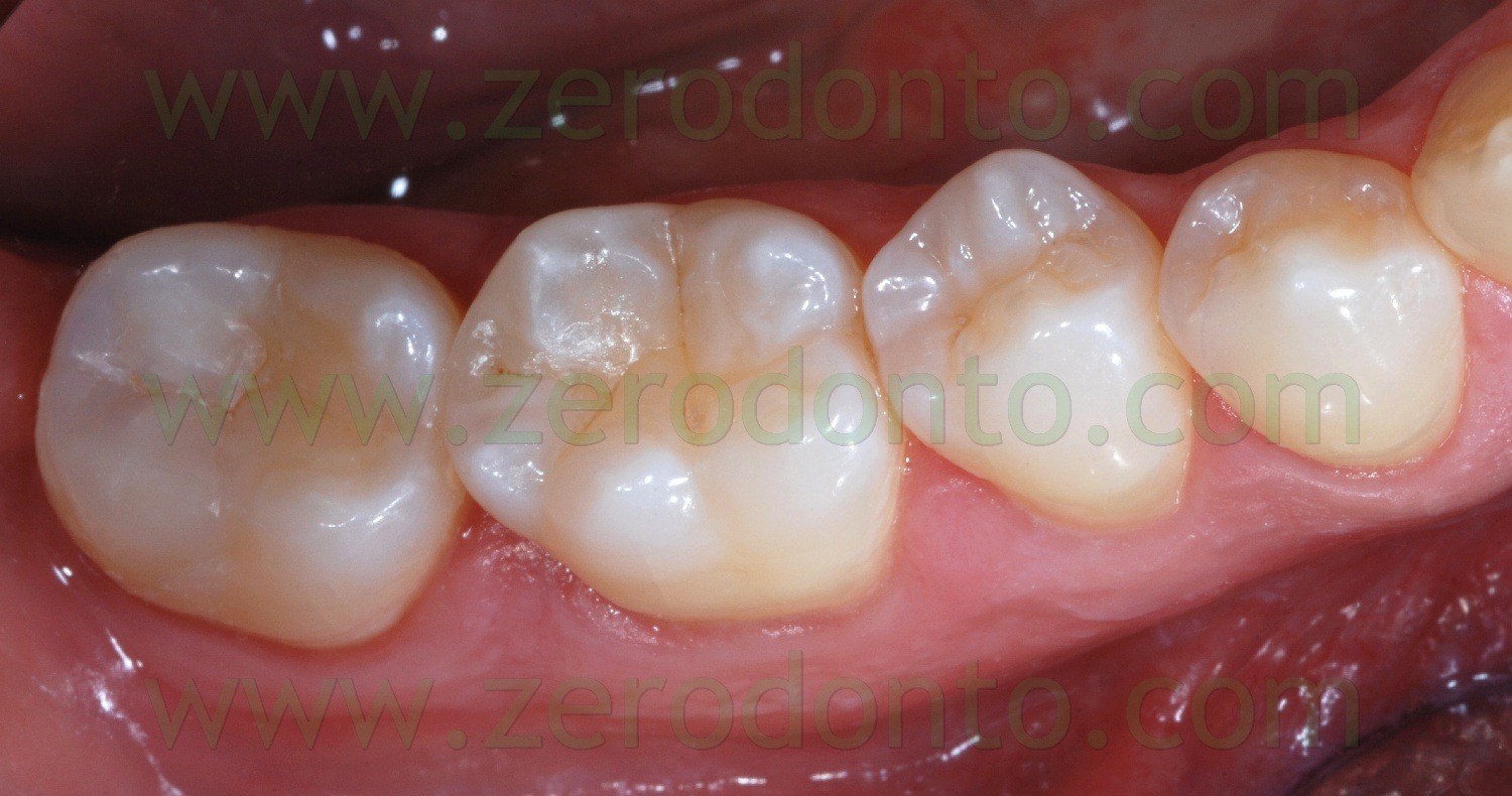 [Fig0081Rosti Q4[2].jpg]