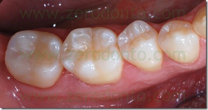 Fig0081Rosti Q4