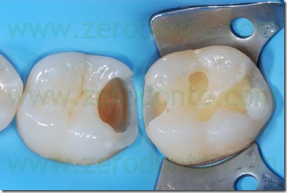 Fig0084Rosti Q3