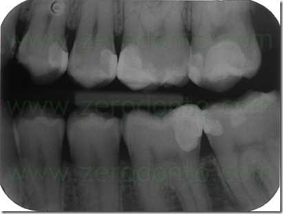 Fig0099Rosti fin