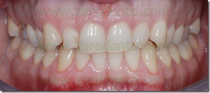 Fig0003Rosti Q1