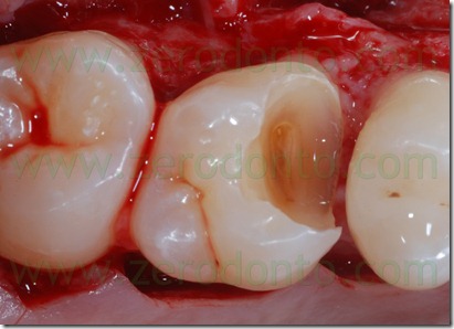 Fig0023Rosti Q1