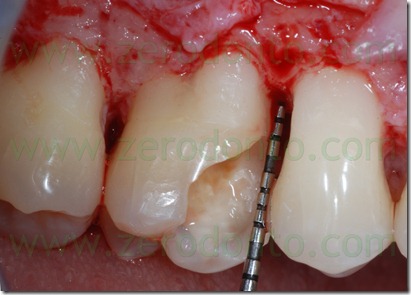 Fig0025Rosti Q1