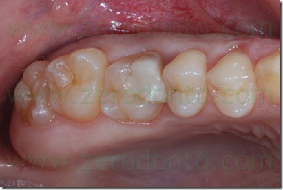 Fig0008Rosti Q1