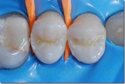 Fig0013Rosti Q1