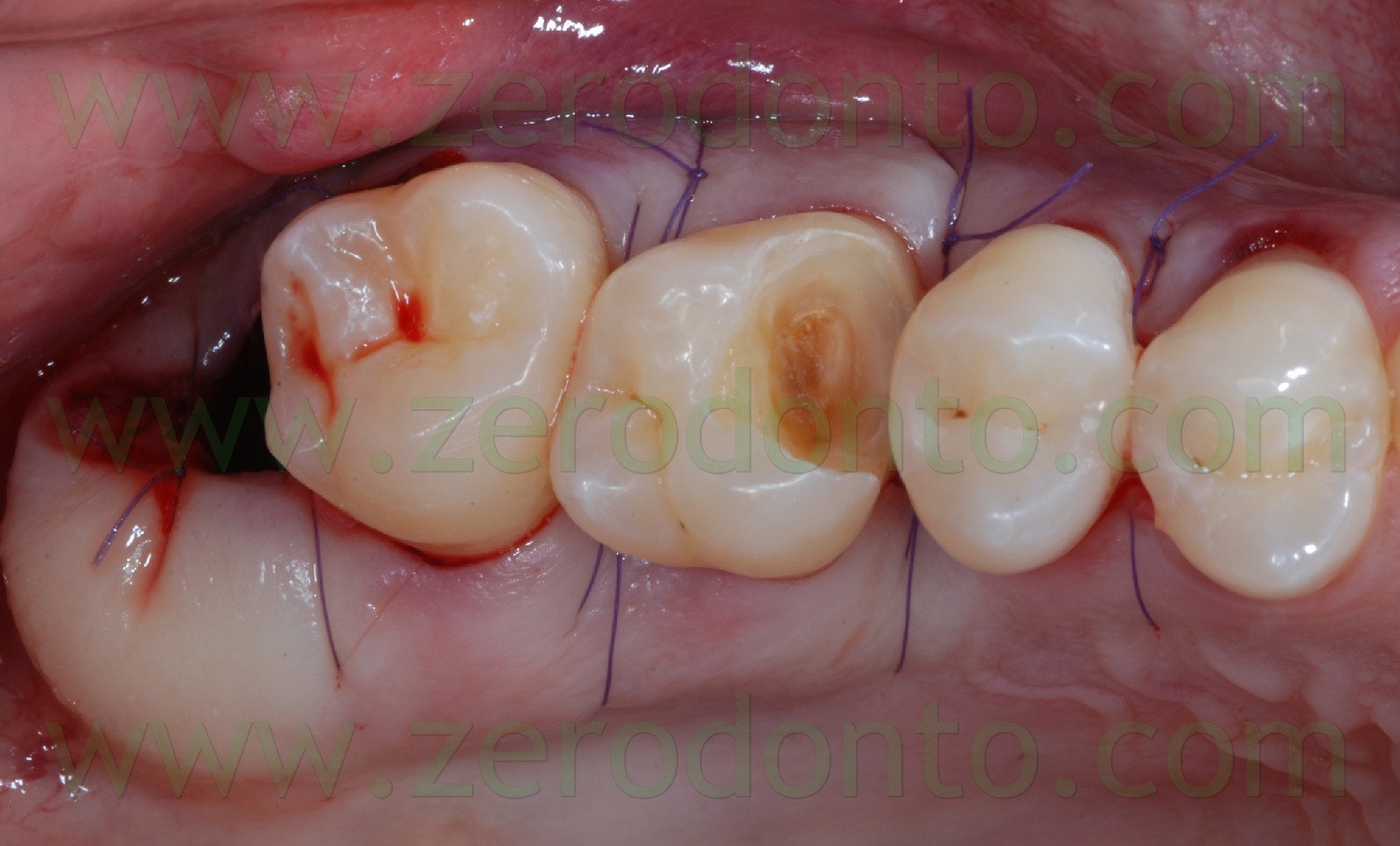 [Fig0026Rosti Q1[2].jpg]