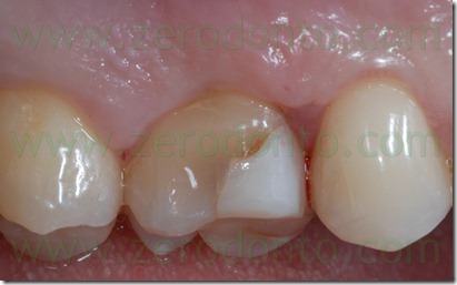 Fig0016Rosti Q1