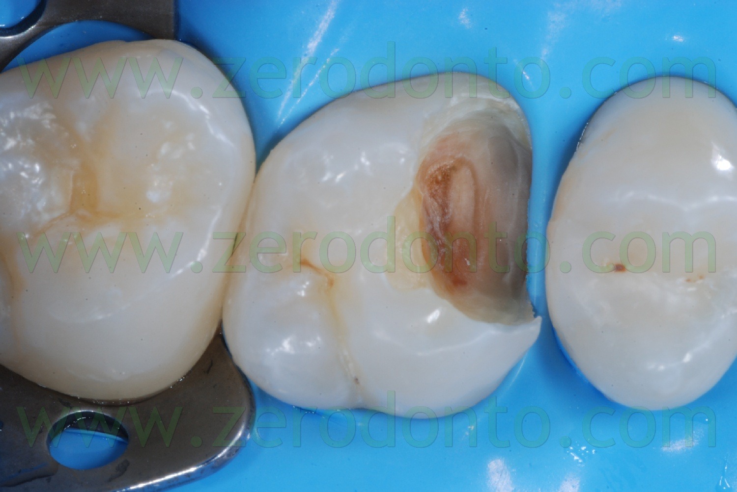 [Fig0019Rosti Q1[5].jpg]