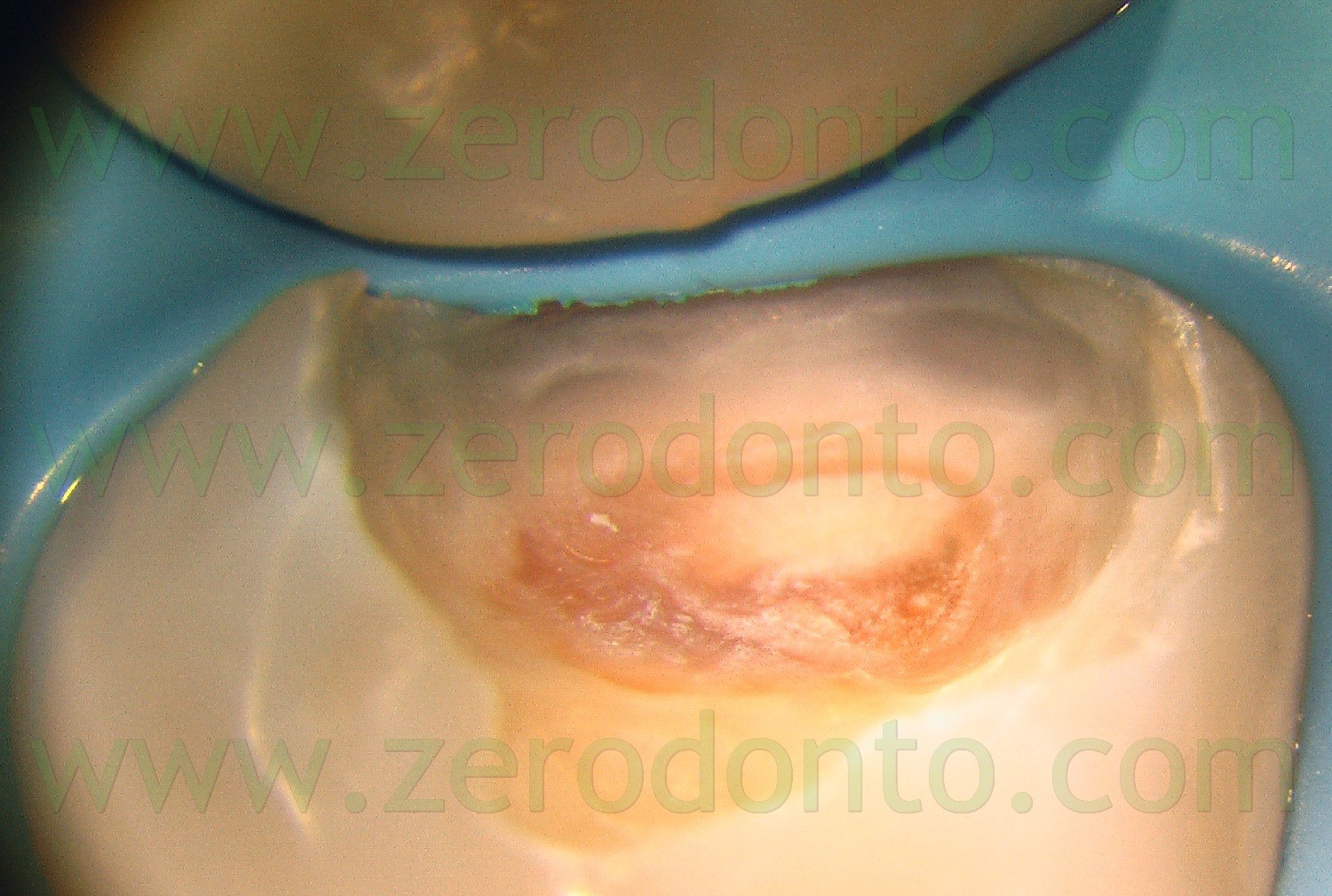 [Fig0021Rosti Q1[2].jpg]