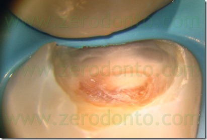 Fig0021Rosti Q1
