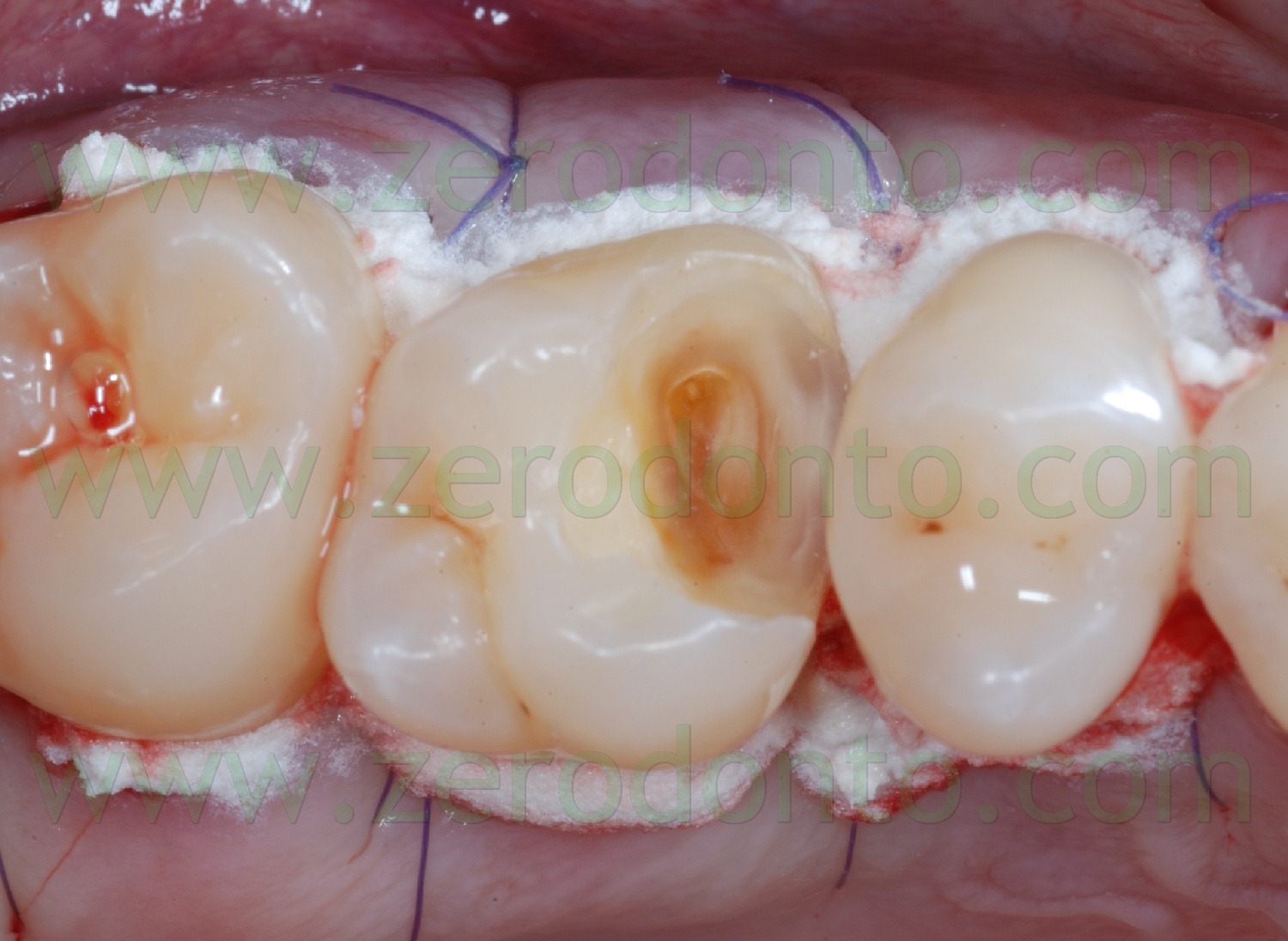 [Fig0027Rosti Q1[2].jpg]