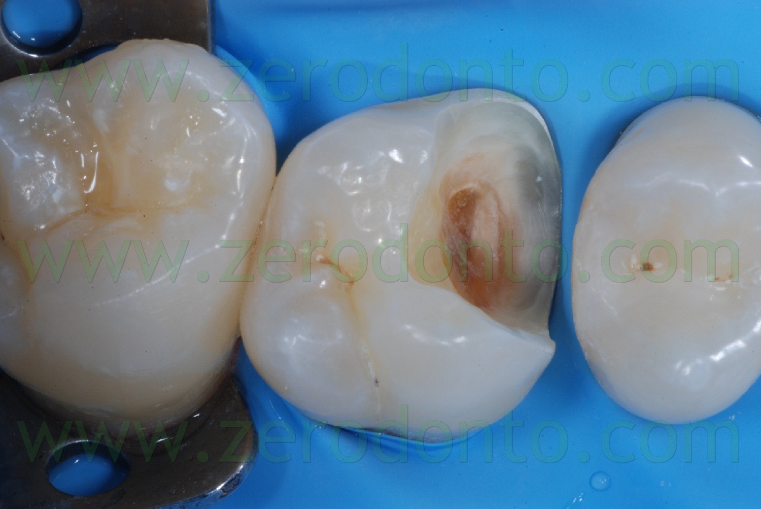 [Fig0028Rosti Q1[2].jpg]