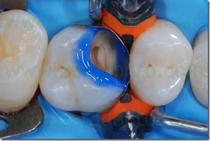 Fig0030Rosti Q1