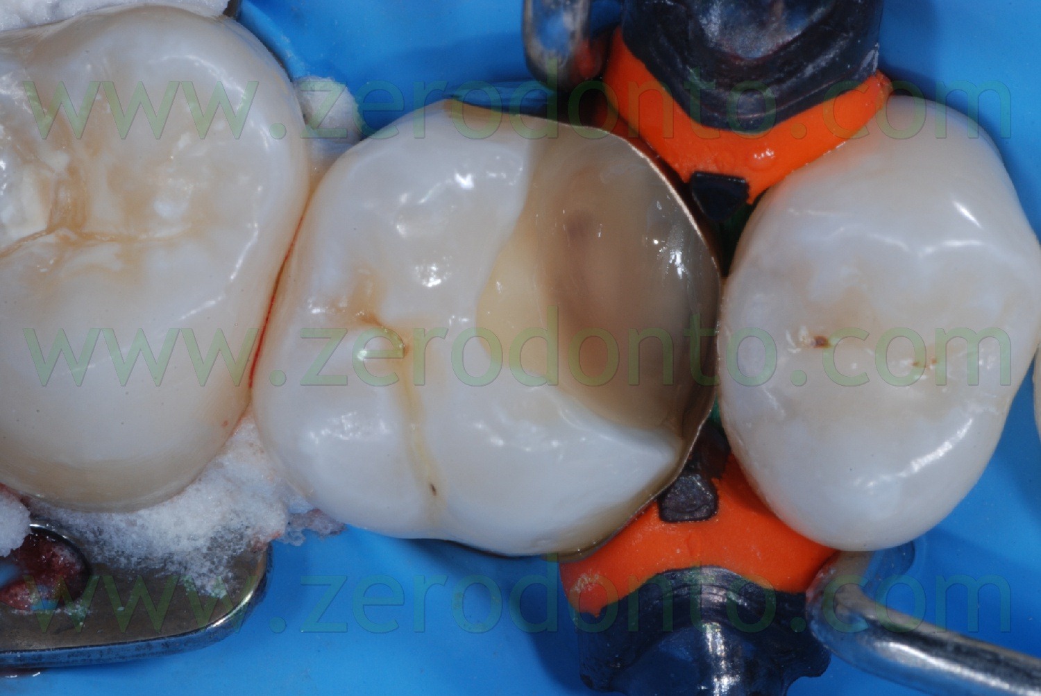 [Fig0033Rosti Q1[2].jpg]
