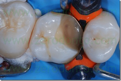 Fig0033Rosti Q1