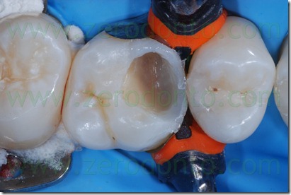 Fig0035Rosti Q1