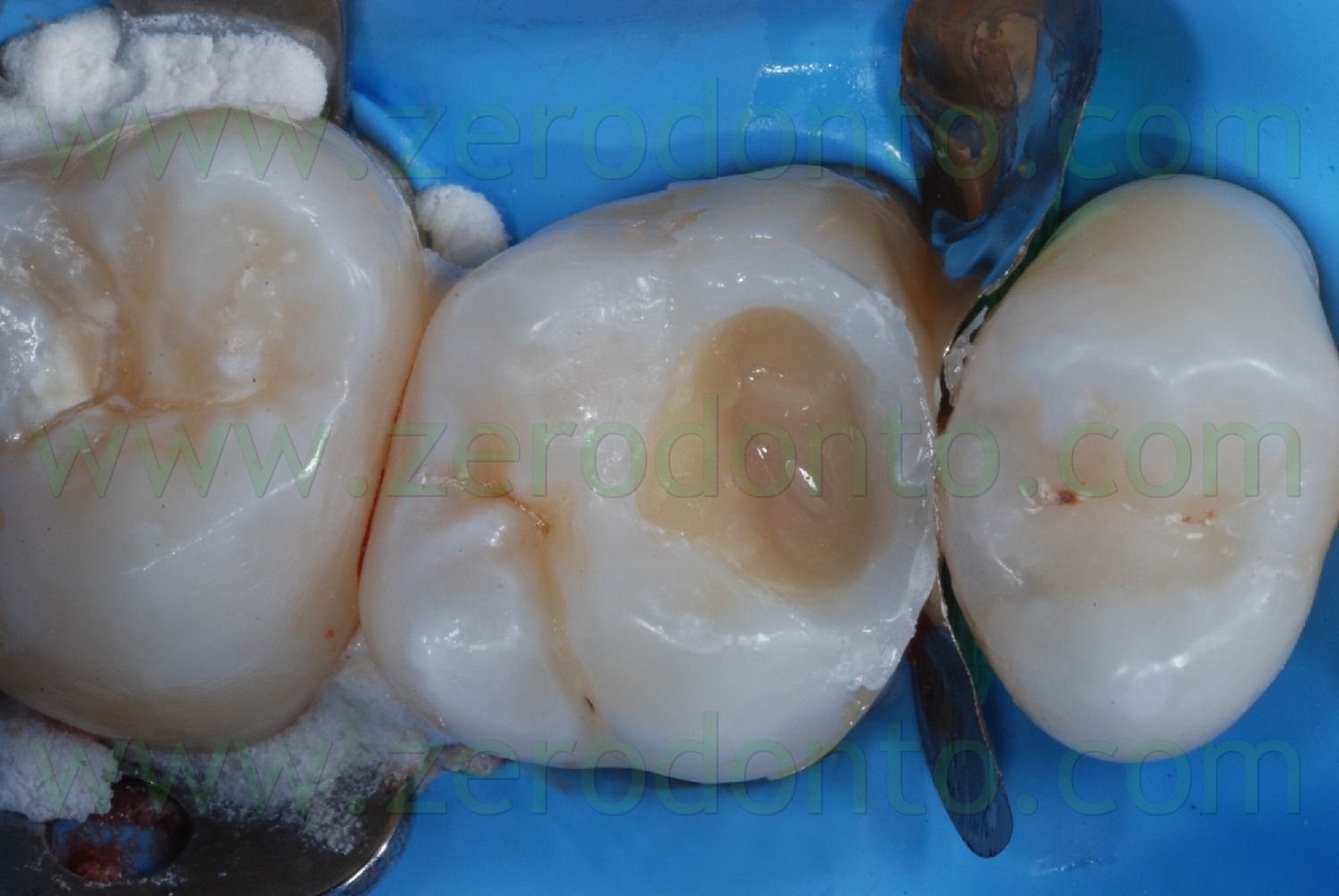 [Fig0036Rosti Q1[2].jpg]