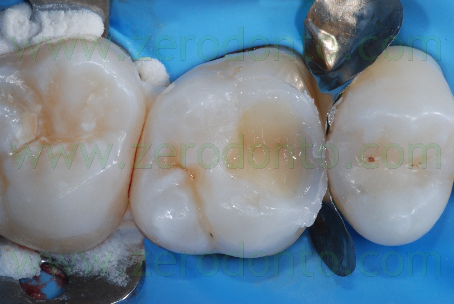 [Fig0037Rosti Q1[2].jpg]