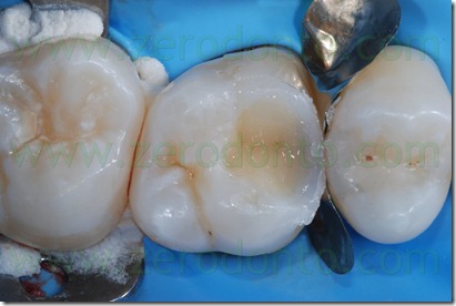 Fig0037Rosti Q1