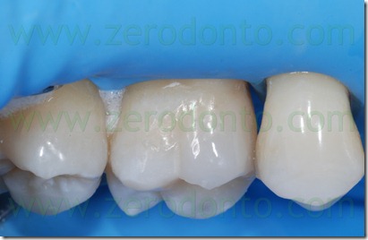 Fig0040Rosti Q1