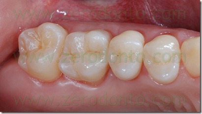 Fig0043Rosti Q1