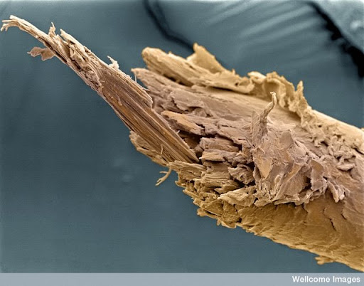 Sel-sel Mikroskopik Tubuh Manusia [ www.BlogApaAja.com ]