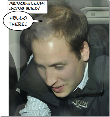 is prince william balding. or Prince William is now