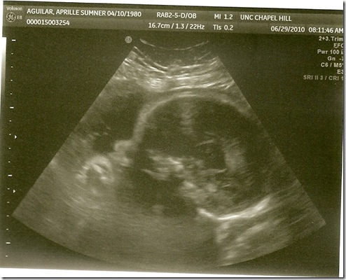 scan0010