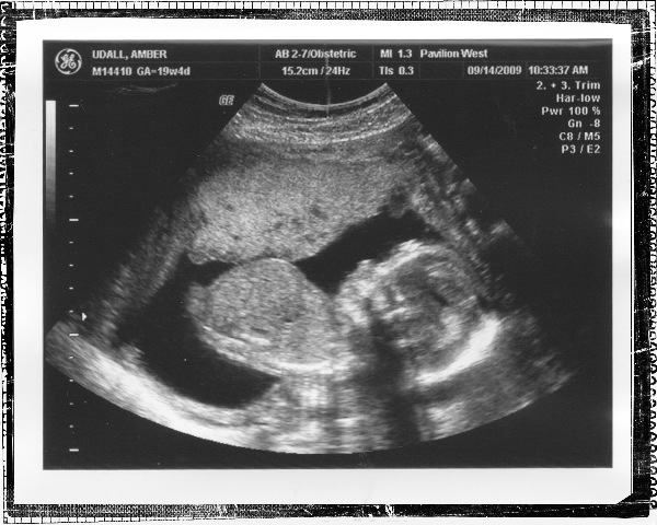 [Ultrasound Boy Profile 3 copy[2].jpg]