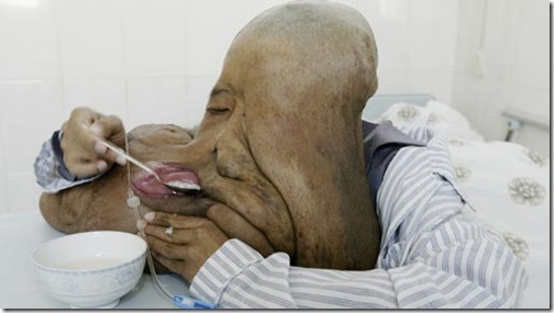 el-hombre-elefante-00001-512x288-la el-hombre-elefante-00001-512x288-la